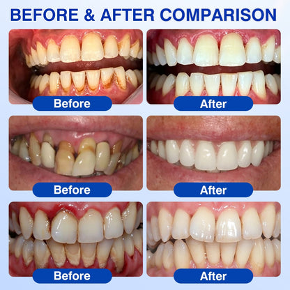 🏅🦷🛡️Evolvion® GumRevive Periodontal Repair Gel