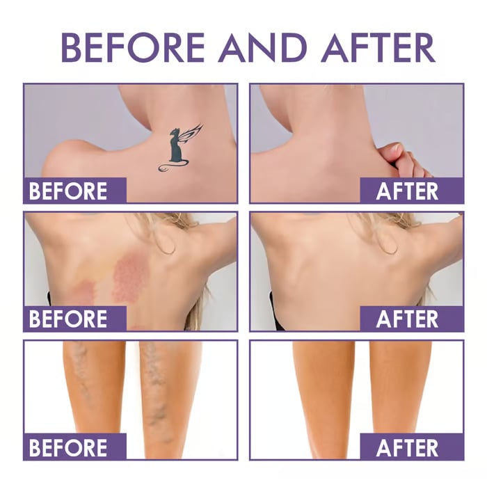 ✨ Body Coverage Perfector – Waterproof, lightweight & flawless body makeup