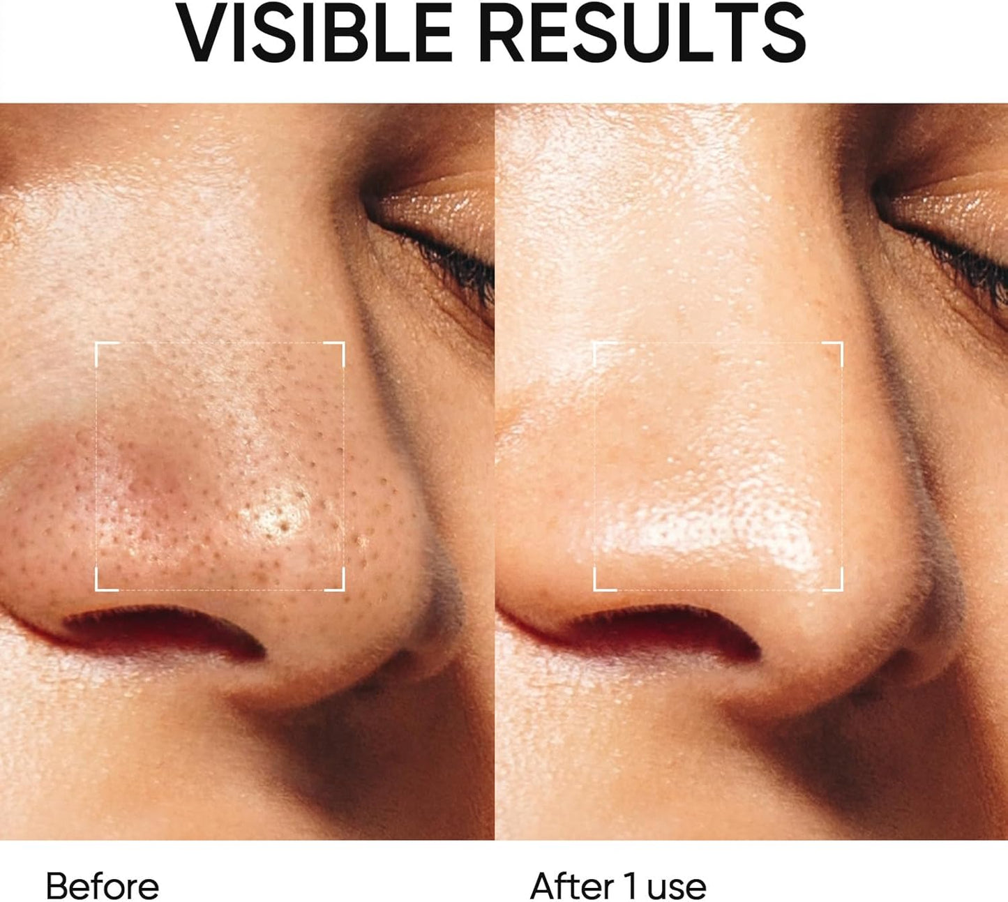 Skintific Alaska Volcano Blackhead & Pore Deep Cleansing Clay Mask Stick