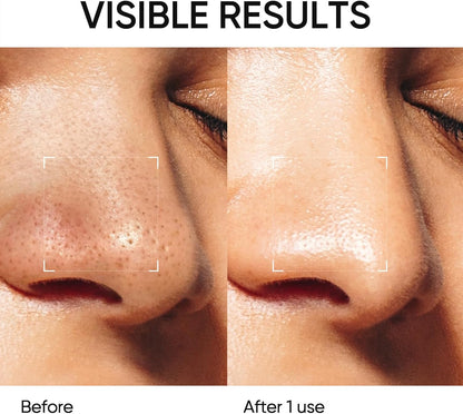 Skintific Alaska Volcano Blackhead & Pore Deep Cleansing Clay Mask Stick