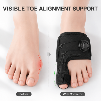 👣50% OFF TODAY✨ Bunion Relief Toe Corrector